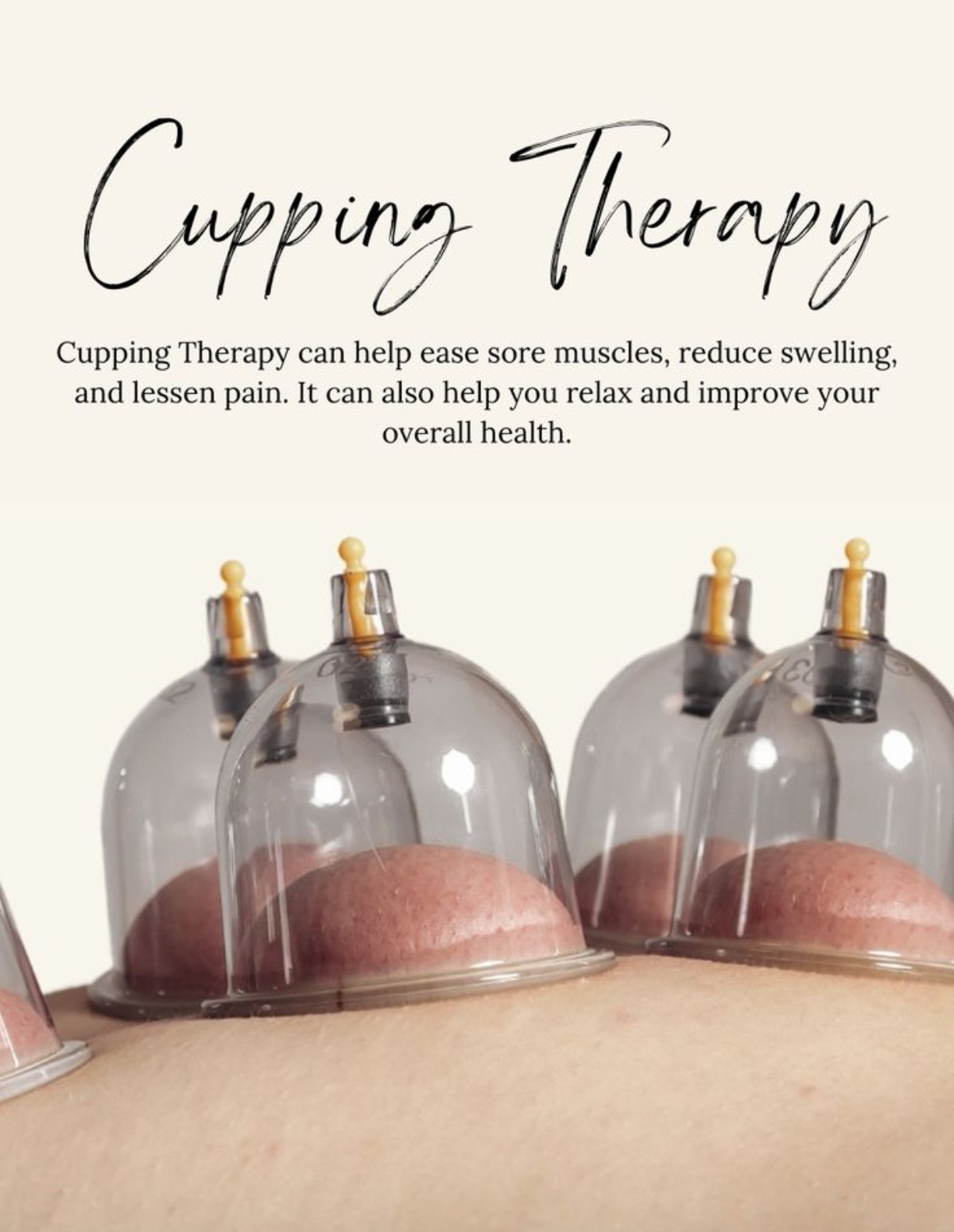 Dry Cupping Massage